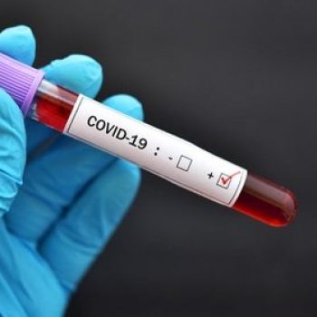 Uji Swab PCR RSBT Bagi Tenaga Medis Gratis, Ditalangi PT Timah